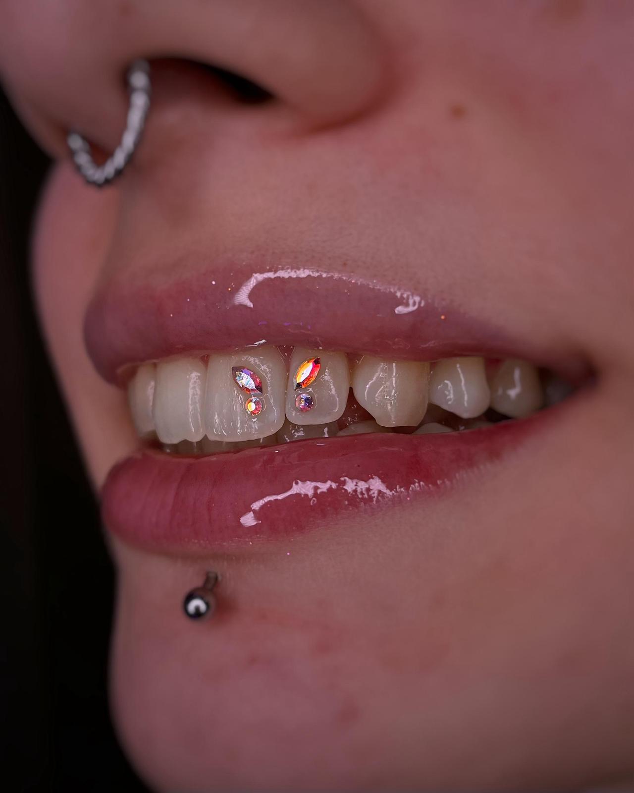 Gemme Dentali